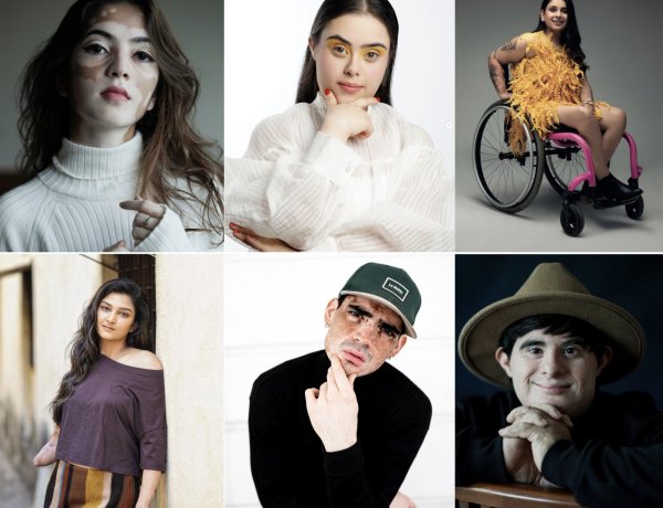 Redefining Beauty: Abhishek Golecha's Unique is Beautiful platform For Specially Abled Humans Is Really Inspiring