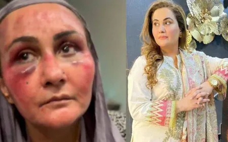 Pakistani actress told the story of her husband dragging her hair, hitting with a gun