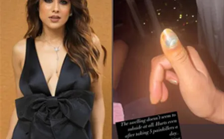 Nia Sharma is taking 5 painkillers in a day, asked for suggestions from the fans