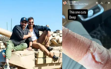 Varun Dhawan injured during the shooting of 'Border 2', shared the photo himself and said - the wound is deep