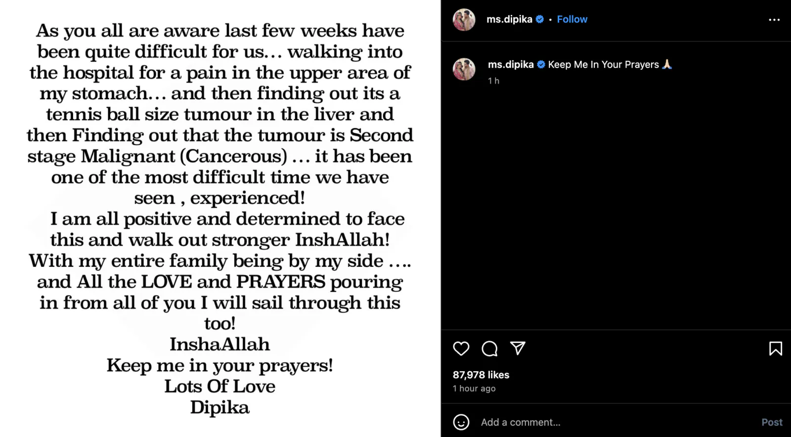Dipika Kakar has second stage cancer, said - 'Keep me in your prayers'
