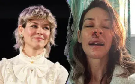 Hollywood actress's face badly damaged, serious injury on nose and lip; said- 'It's good...'