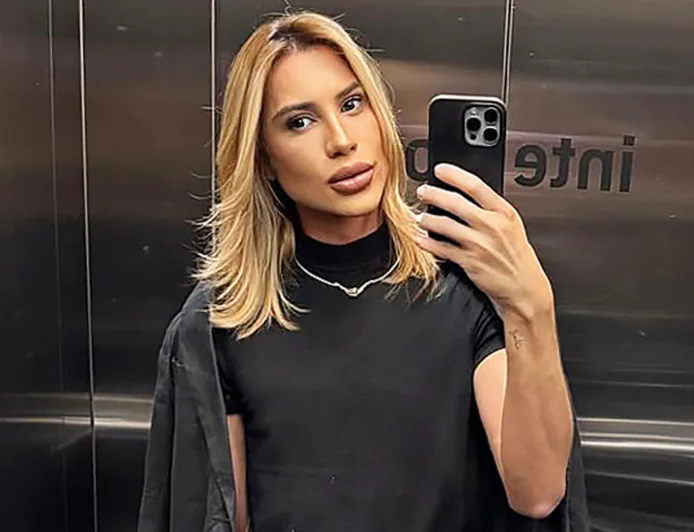Brazilian Influencer Adair Mendes Dutra Junior Dies After Eye Surgery at 31