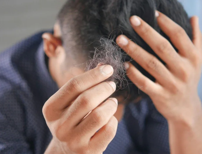 What Are the Main Causes of Hair Fall in Men?